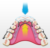 img-aligner